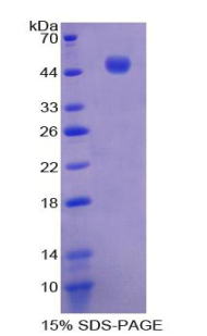 Recombinant Interleukin 21 (IL21)