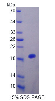 Recombinant Interleukin 25 (IL25)