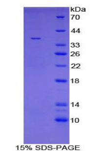 Recombinant TATA Binding Protein (TBP)