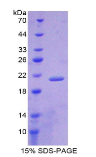 Recombinant Lipocalin 1 (LCN1)