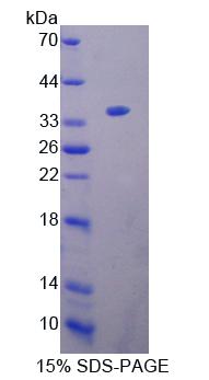 Recombinant Kell Protein (KEL)