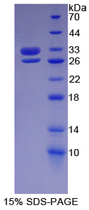 Recombinant Basal Cell Adhesion Molecule (BCAM)