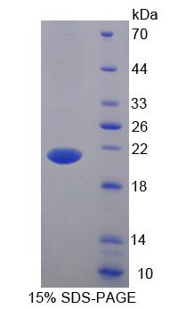 Recombinant B And T-Lymphocyte Attenuator (BTLA)