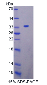 Recombinant Oncoprotein Induced Transcript 3 (OIT3)