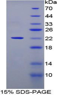 Recombinant Cluster Of differentiation 299 (CD299)