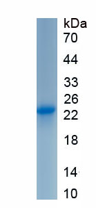 Recombinant Cluster Of differentiation 301 (CD301)