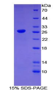 Recombinant Cluster Of differentiation 301 (C<b>D301</b>)