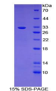 Recombinant B-Cell CLL/Lymphoma 3 (Bcl3)