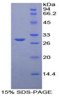 Recombinant B-Cell CLL/Lymphoma 3 (Bcl3)