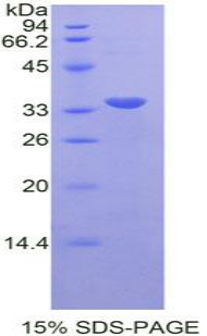 Recombinant Signal Transducer And Activator Of Transcription 6 (STAT6)