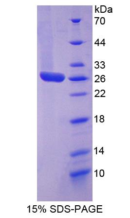 Recombinant Signal Transducer And Activator Of Transcription 3 (STAT3)