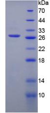 Recombinant Phosphofructokinase, Platelet (PFKP)