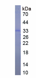 Recombinant Ribonuclease A3 (RNASE3)