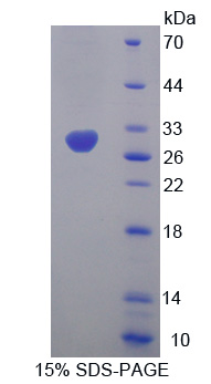 Recombinant Hydroxymethylglutaryl Coenzyme A Synthase (HMGCS)