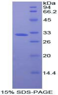 Recombinant Oncostatin M Receptor (OSMR)