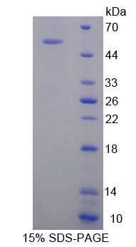 Recombinant Oncostatin M Receptor (OSMR)