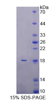 Recombinant Killer Cell Lectin Like Receptor Subfamily K, Member 1 (KLRK1)