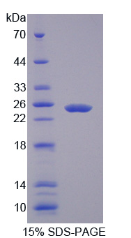 Recombinant Lectin Galactoside Binding, Soluble 3 Binding Protein (LGALS3BP)