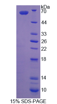 Recombinant Lectin Galactoside Binding, Soluble 3 Binding Protein (LGALS3BP)