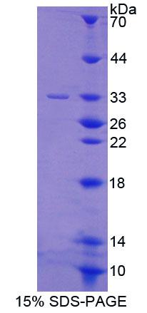 Recombinant Prostaglandin F2 Receptor Negative Regulator (PTGFRN)