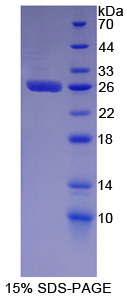 Recombinant Minichromosome Maintenance Deficient 2 (MCM2)