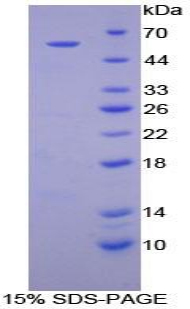 Recombinant Transglutaminase 1 (TGM1)