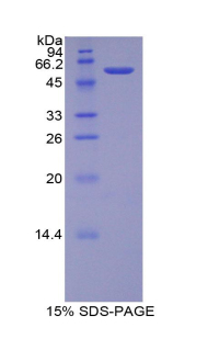 Recombinant Transglutaminase 1 (TGM1)