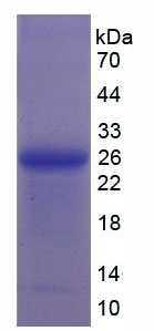 Recombinant Orosomucoid 2 (ORM2)