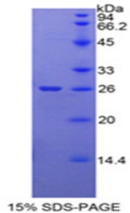 Recombinant Orosomucoid 2 (ORM2)