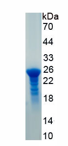 Recombinant Junctional Adhesion Molecule 2 (JAM2)