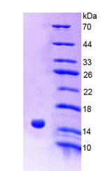 Recombinant Receptor Interacting Serine Threonine Kinase 2 (RIPK2)