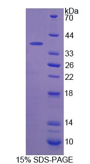 Recombinant Receptor Interacting Serine Threonine Kinase 2 (RIPK2)