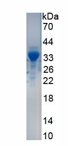 Recombinant Tumor Associated Calcium Signal Transducer 2 (TACSTD2)