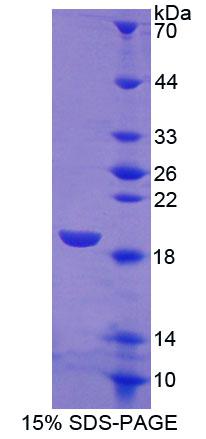 Recombinant Sialic Acid Binding Ig Like Lectin 7 (SIGLEC7)