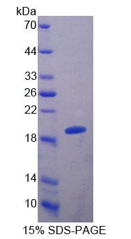 Recombinant S100 Calcium Binding Protein A8 (S100A8)