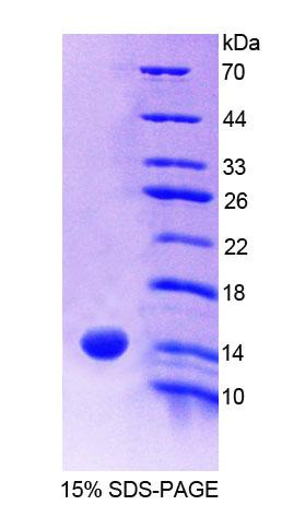 Recombinant S100 Calcium Binding Protein A9 (S100A9)