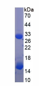 Recombinant S100 Calcium Binding Protein A9 (S100A9)