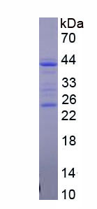 Recombinant Cluster Of Differentiation 5 (CD5)