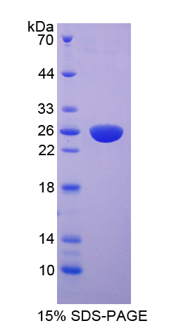 Recombinant Fibroblast Growth Factor Receptor 4 (FGFR4)