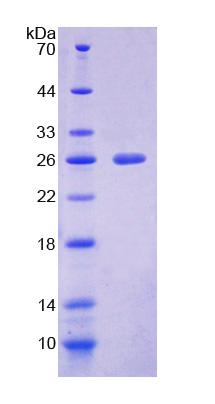 Recombinant Natural Cytotoxicity Triggering Receptor 1 (NCR1)