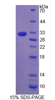 Recombinant Natural Cytotoxicity Triggering Receptor 1 (NCR1)