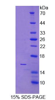 Recombinant Natural Cytotoxicity Triggering Receptor 3 (NCR3)