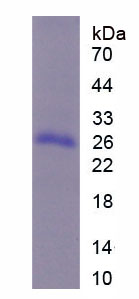 Recombinant High Molecular Weight Kininogen (HMWK)