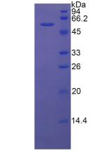 Recombinant High Molecular Weight Kininogen (HMWK)