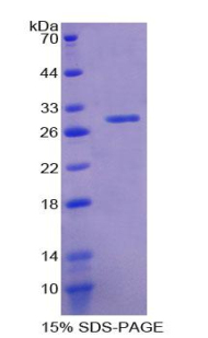 Recombinant Selenoprotein P1, Plasma (SEPP1)