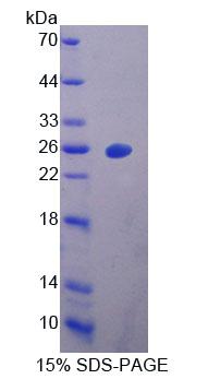 Recombinant Vitamin D Binding Protein (DBP)