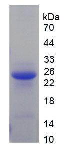 Recombinant Vitamin D Binding Protein (DBP)