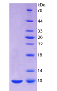 Recombinant Vitamin D Binding Protein (DBP)