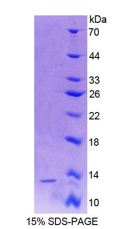 Recombinant Vitamin D Binding Protein (DBP)