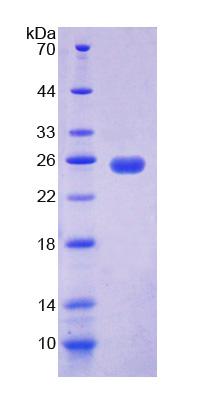 Recombinant Uridine Phosphorylase 1 (UPP1)